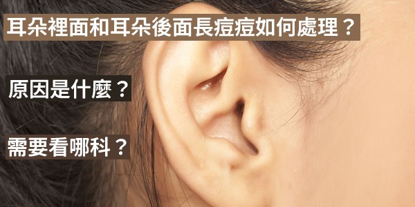 耳朵裡面和耳朵後面長痘痘如何處理？原因是什麼？需要看哪科？