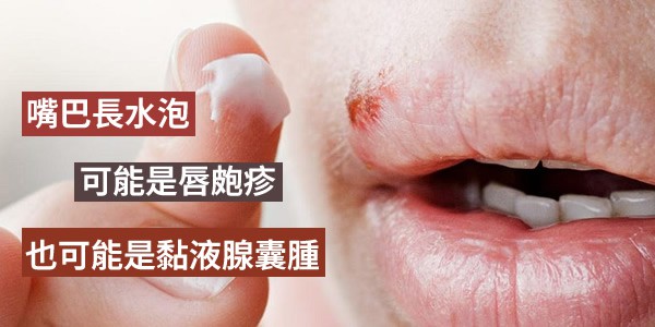嘴巴長水泡可能是唇皰疹，也可能是黏液腺囊腫