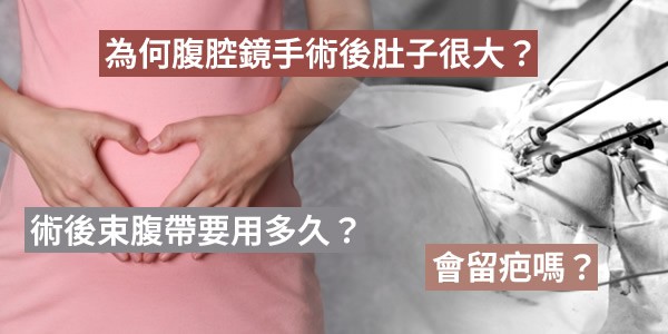 為何腹腔鏡手術後肚子很大？術後束腹帶要用多久？會留疤嗎？