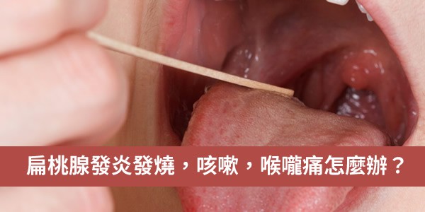 扁桃腺發炎發燒，咳嗽，喉嚨痛怎麼辦？可以打針舒緩嗎？ 